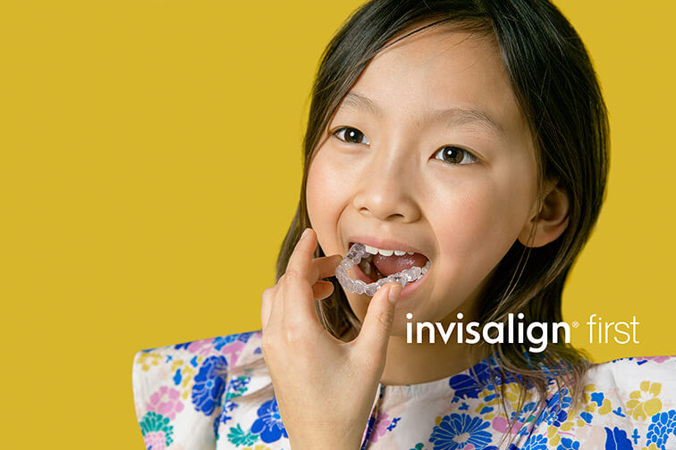 young girl putting her Invisalign aligner onto her teeth