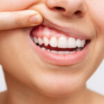 Closeup of a woman pulling up her upper lip to show her healthy gums in jonesboro