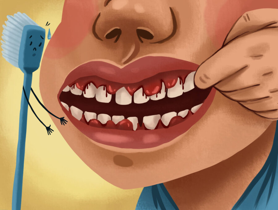 Illustration of a patient with bleeding gums with a sad-looking toothbrush reaching out to help